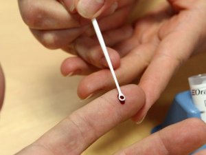 Фото: Полтавців безкоштовно тестуватимуть на гепатит