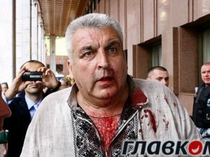 Полтавський екс-кандидат у мери постраждав у Києві у протесті за мову (фото)