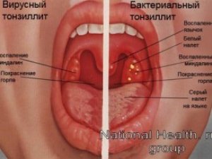 Фото: Найпоширеніші ЛОР-проблеми, або Чому хворіємо на застуду у спеку і як із цим боротись