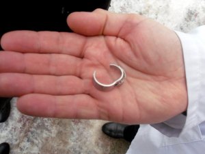 Фото: Вихованцю полтавського інтернату рятувальники зрізали з пальця перстень